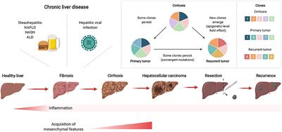 The Role of Chronic Liver Diseases in the Emergence and Recurrence of Hepatocellular Carcinoma: An Omics Perspective